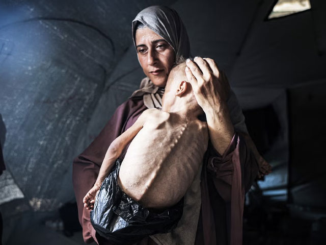 غزہ کے فلسطینی ’چلتی پھرتی لاشوں‘ میں تبدیل ہورہے ہیں: اقوام متحدہ